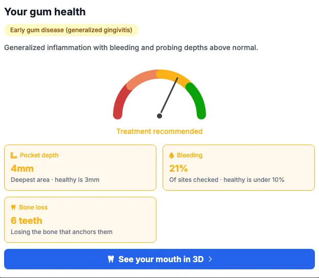 Sample patient report showing a gum-health meter, pocket depth, bleeding, bone loss and a link to the 3D view