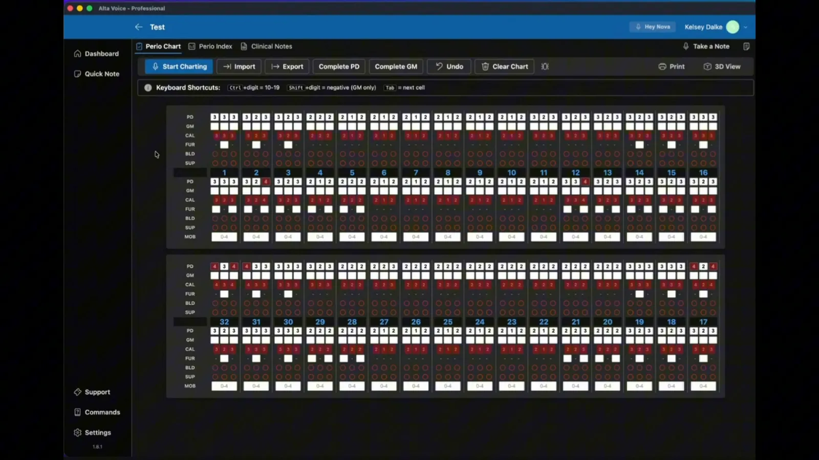 Recorded Alta Voice Perio chart with completed measurements and review controls